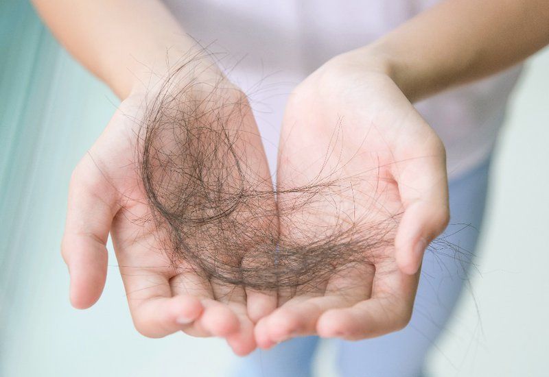 Tóc rụng – bao nhiêu là bình thường, bao nhiêu là báo động?