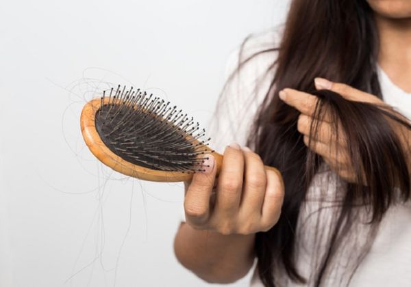 Nguyên nhân rụng tóc phổ biến và cách giảm rụng tóc hiệu quả
